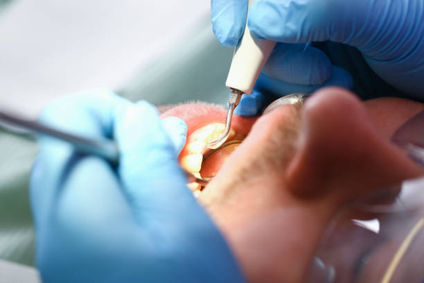 Best Emergency Tooth Extraction in Grant, MN