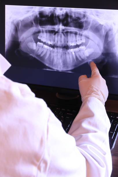 Best Emergency Dental Care for Broken or Chipped Teeth in Grant, MN